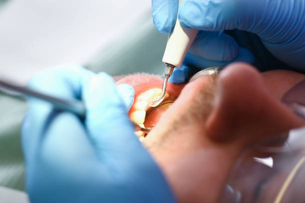Best Emergency Dentist for Lost Fillings or Crowns in Olney, TX